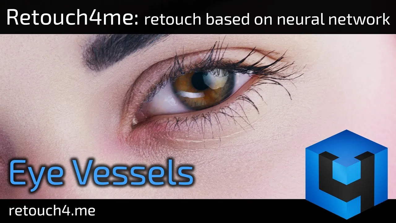 Retouch4me Eye Vessels Retouch4me Eye Vessels